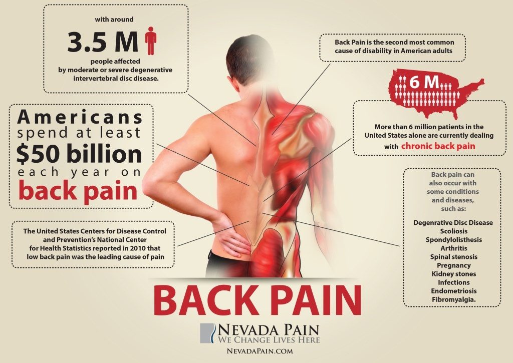 Back Pain Info